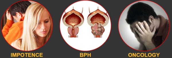 Prostatitis Symptoms