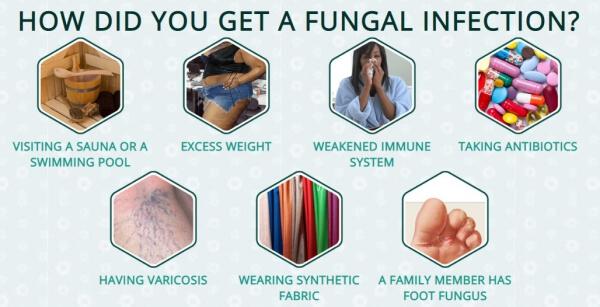 fungal infection, causes