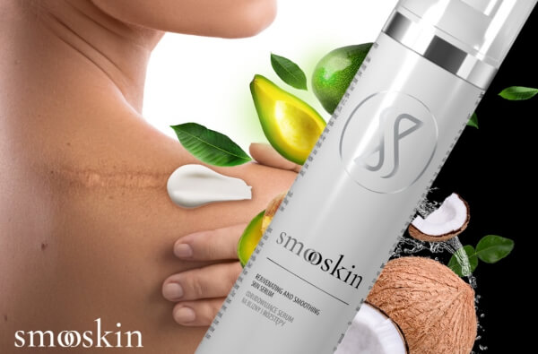 SmooSkin Review – Best Scar and Stretch Mark Removal Cream For Long Lasting Results