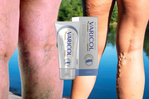  Reducing Varicose Veins